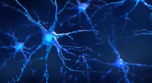 Juni ist Alzheimer & Brain Awareness Month